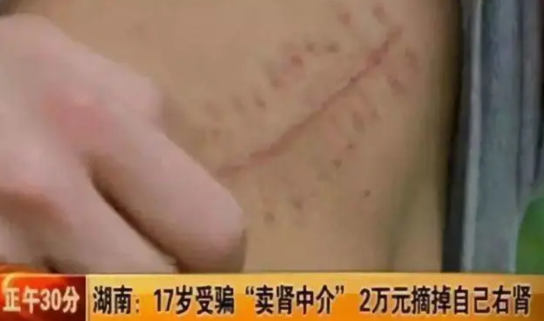 女大学生“以性换租”：一周2次，600块就把自己卖给了房东......(图25)